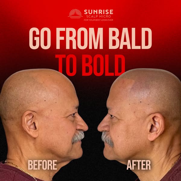 Affordable bald