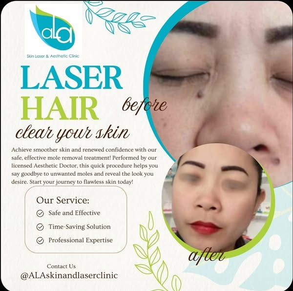 Flawless procedure